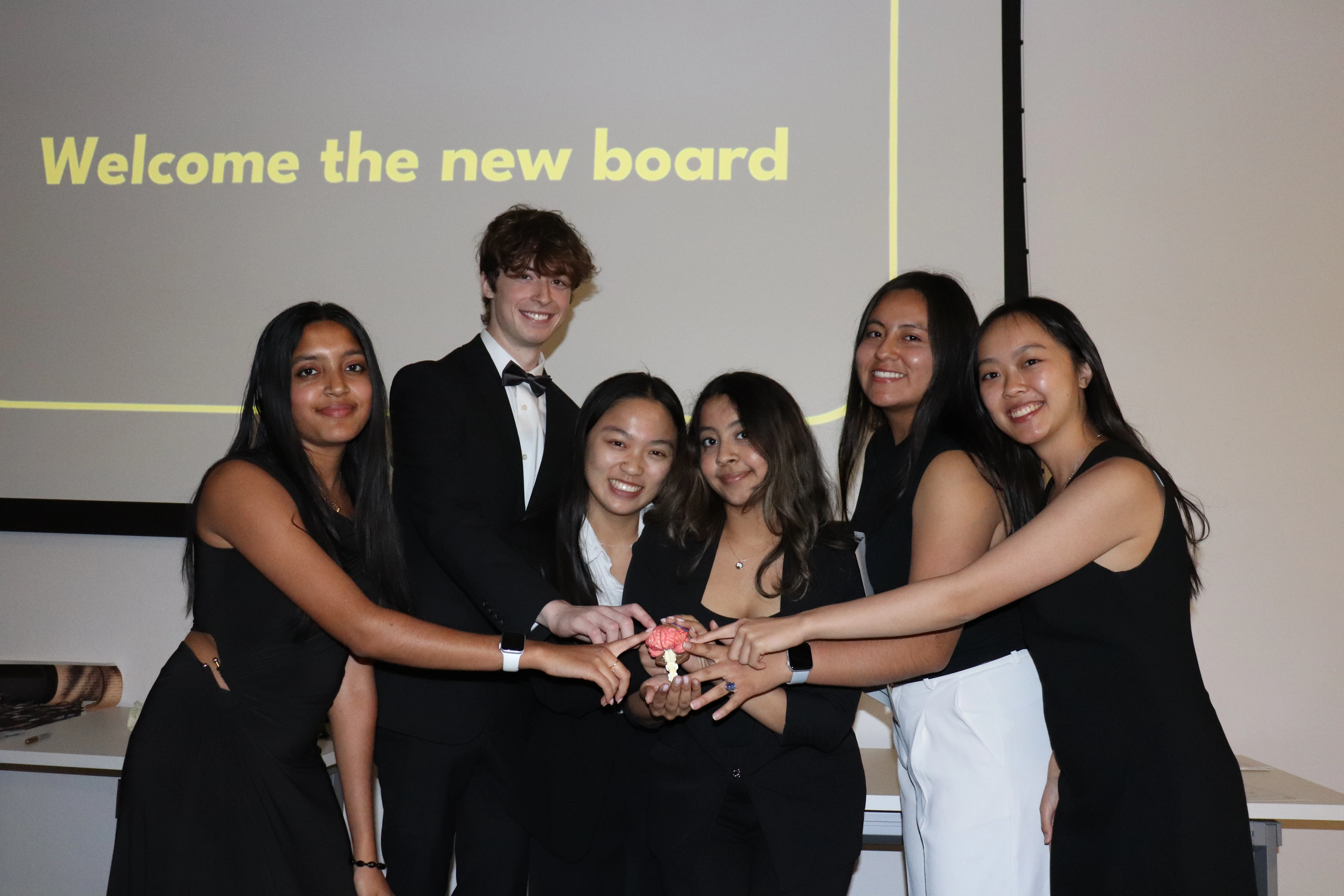 Six well dressed students gatherer around with their index fingers on a model brain.